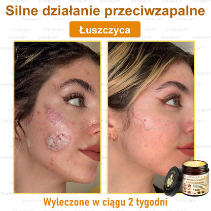 ✨FOVHEAl™ Krem z Jadem Pszczelim – Wygładza zmarszczki i przywraca młody wygląd – 50 ml