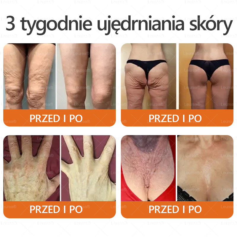 ✨Leurea® Krem Regenerujący z Jadem Pszczelim🔥 Naturalna regeneracja skóry, wygładzenie zmarszczek i promienna cera-50 ml