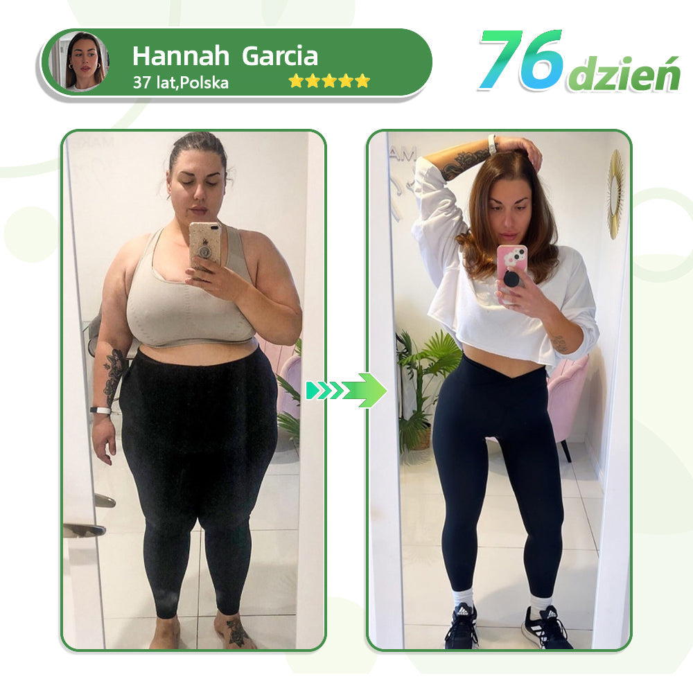 Voilaist® SMGT-GLP-1 Nano Microneedle Patch（Bezbolesny, długotrwały, zwalczający cukrzycę, otyłość i choroby układu krążenia）