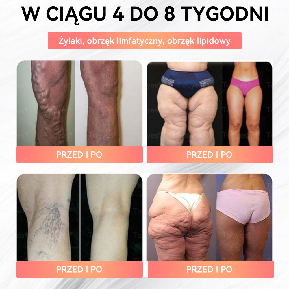 Oficjalny Autoryzowany Sklep – Tooyes® GLP-1 Perły z wysoko skoncentrowanym serum – NAD+, Moringa i HCA — skuteczna formuła dla Twojego ciała i zdrowia. Stworzone przez specjalistów, którym możesz zaufać.