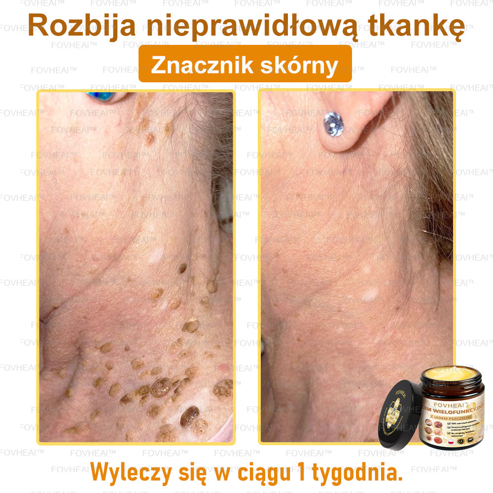 ✨FOVHEAl™ Krem z Jadem Pszczelim – Wygładza zmarszczki i przywraca młody wygląd – 50 ml
