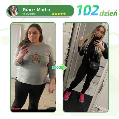 🔥Voilaist® SMGT-GLP-1 Nano Microneedle Patch（Bezbolesny, długotrwały, zwalczający cukrzycę, otyłość i choroby układu krążenia）