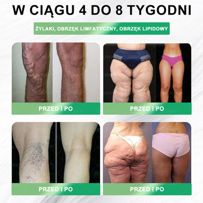🌱 DOOEKA® GLP-1 8 w 1 Fit & Vital roztwór doustny – Raz dziennie, widoczne zmiany w ciągu 7 dni / W przypadku otyłości, zdrowia serca i układu krążenia, cukrzycy, bezdechu sennego, zdrowia jelit, problemów ze stawami i wielu innych