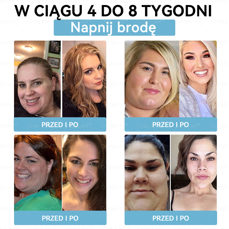 CrazyLeaf® Szczupłość i Witalność Tirzepatide – doustny roztwór wspierający odchudzanie, ciśnienie i poziom cukru